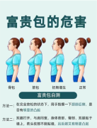 读懂富贵包的症状与成因，微创告别颈后臃肿与肩颈不适